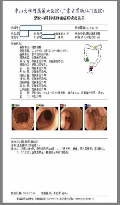 5毫米的息肉拖成癌！医生感叹：可惜错过了2个重要时机！