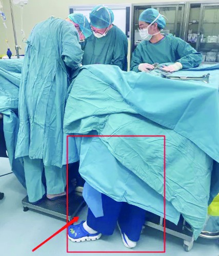 手术台下,助产士弯腰托举22分钟