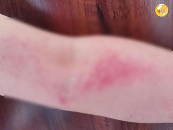 有毒，小心！西安一男子因此入院治疗，很多人家里都有......