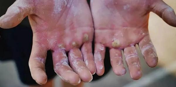 希望这些照片能让更多人看见，除了他们的妈妈