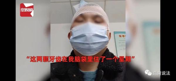 太离谱！“两颗牙齿在我脑袋里住了一个星期”？！