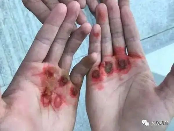 希望这些照片能让更多人看见，除了他们的妈妈