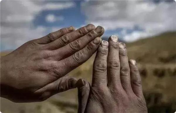 希望这些照片能让更多人看见，除了他们的妈妈