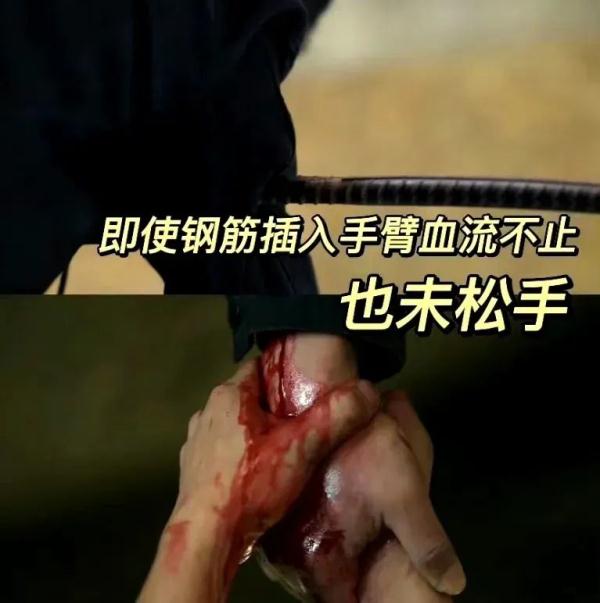 《狂飙》里安欣的肩啥情况？医生解读