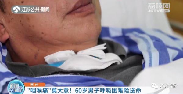 突然喉咙痛,男子呼吸困难险送命!这种嗓子疼千万别忽视! 突然喉咙痛,男子呼吸困难险送命!这种嗓子疼千万别忽视!