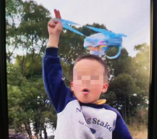 痛心！邻居随手扔出爆竹7岁男孩永失右臂，目前仍在治疗，最新进展来了