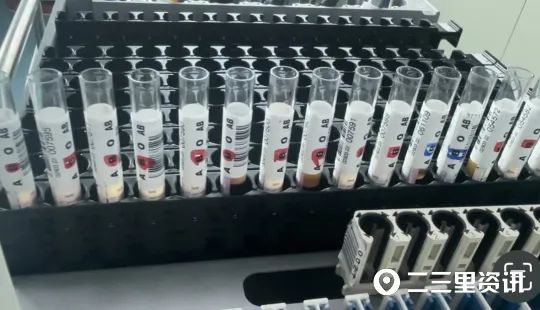 全球罕见!发现1例黄金血型 全球罕见!发现1例黄金血型