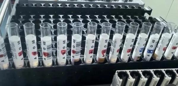 全球罕见!比“熊猫血”更稀有 全球罕见!比“熊猫血”更稀有