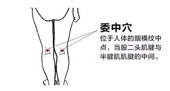 记住这一招，急性腰扭伤快速缓解！