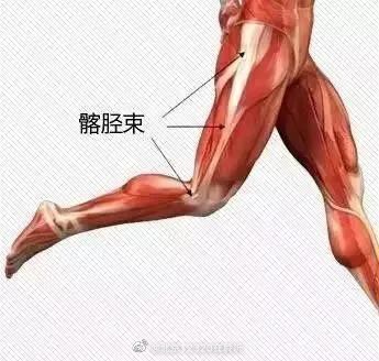 为什么会发生髂胫束摩擦综合征？