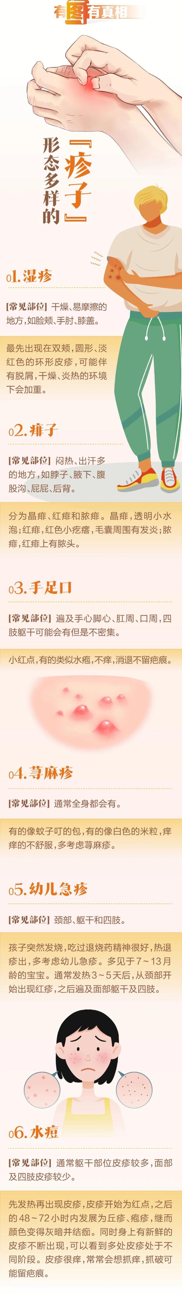 身上有小红点,别不当回事!可能是肾损伤! 身上有小红点,别不当回事!可能是肾损伤!