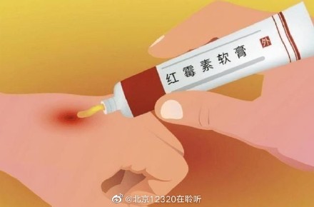 红霉素软膏的功效有哪些? 红霉素软膏的功效有哪些?