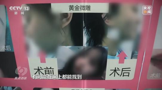 给你整容的“医学博士”,可能初中毕业 给你整容的“医学博士”,可能初中毕业