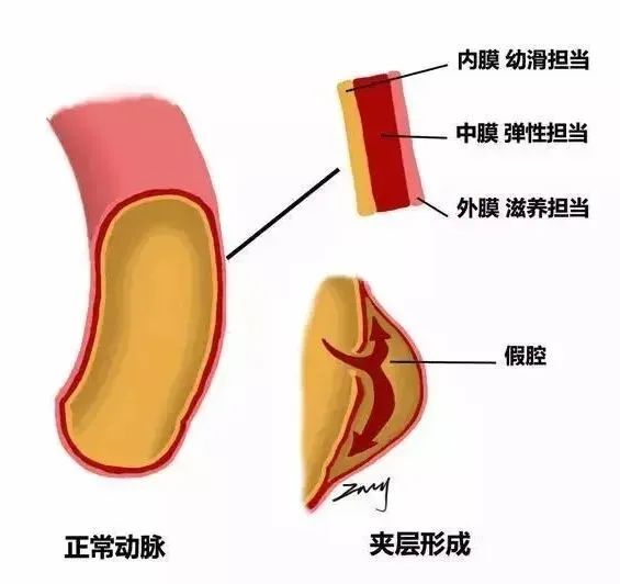 太凶险！厦门连发34例！33岁女子紧急抢救6小时！医生提醒……