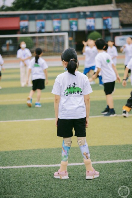 无腿舞者廖智重庆创业，30多名腿部残疾儿童因她重新“站起来”