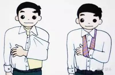 肩膀脱臼怎么办？