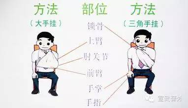 肩膀脱臼怎么办？