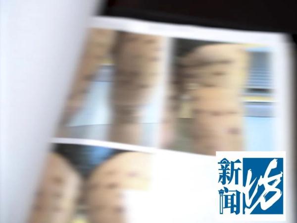 全身溃烂、感染！沪上5位爱美姑娘的一个决定…这伤口太可怕了