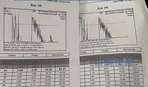 冲上热搜!1岁宝宝近视600度,最坏的结果可能失明......原因与父母有关? 冲上热搜!1岁宝宝近视600度,最坏的结果可能失明......原因与父母有关?