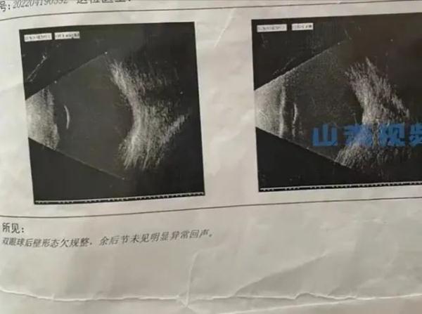 冲上热搜!1岁宝宝近视600度,最坏的结果可能失明......原因与父母有关? 冲上热搜!1岁宝宝近视600度,最坏的结果可能失明......原因与父母有关?