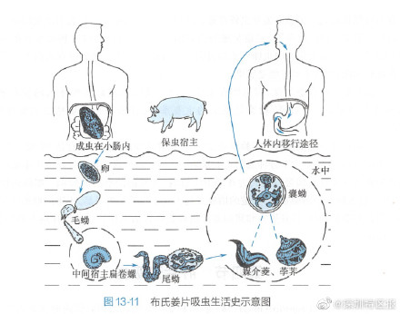 吓人！一女子因生吃荸荠体内长出2条活虫