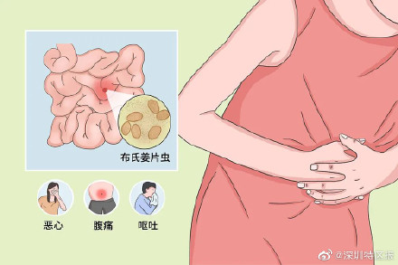 吓人！一女子因生吃荸荠体内长出2条活虫