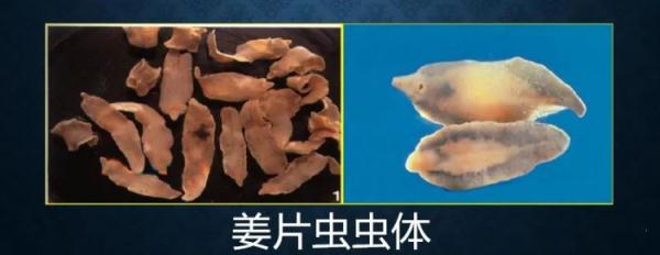 吓人！27岁女子体内揪出2条活虫，竟是因为这东西！很多深圳人爱吃