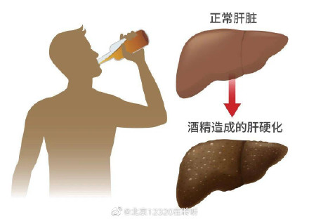 喝酒对年轻人造成的危害究竟有多大? 喝酒对年轻人造成的危害究竟有多大?