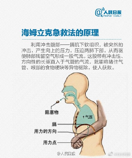 一定要掌握的海姆立克急救法! 一定要掌握的海姆立克急救法!