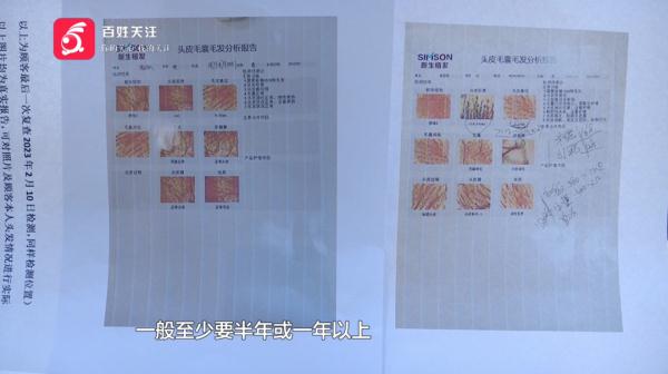 为治脱发去涂药，头发却越掉越多？