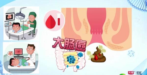 大便出血…是痔疮还是癌症？简单几点，教你辨别！