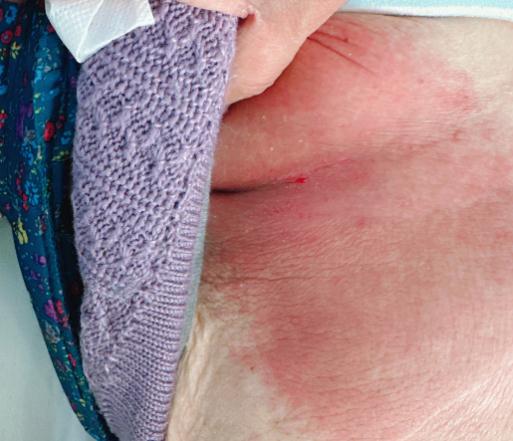 白细胞为0，血小板剩1/10，老人这个举动很危险！