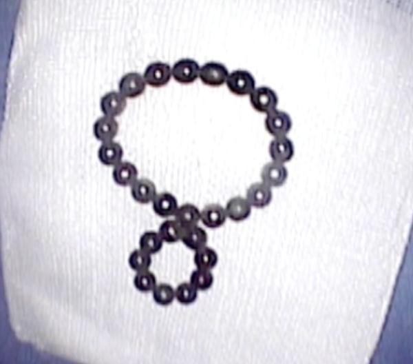 2岁幼童误吞28颗磁力珠！险些造成胃穿孔……医生提醒→