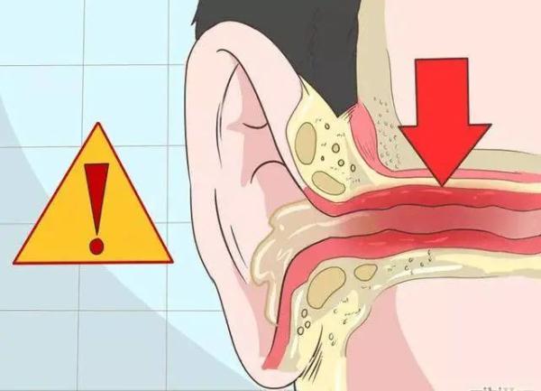 阿伯突然失聪,竟是耳屎惹的祸?佛山医生:千万别做这个动作!