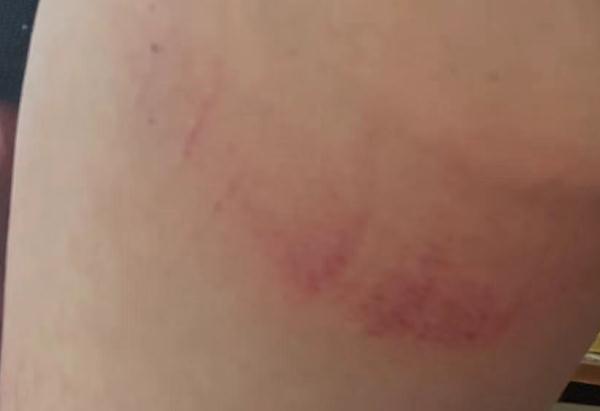 南湖大桥上一男子纵身跳入湖中，而他们紧随其后……