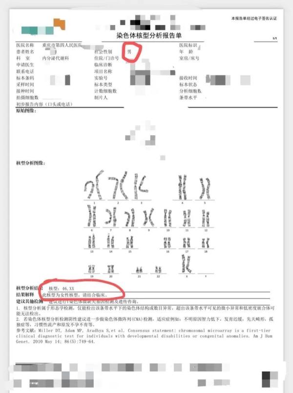 多年求子不得,中年男子查出染色体竟是“女儿身”…… 多年求子不得,中年男子查出染色体竟是“女儿身”……