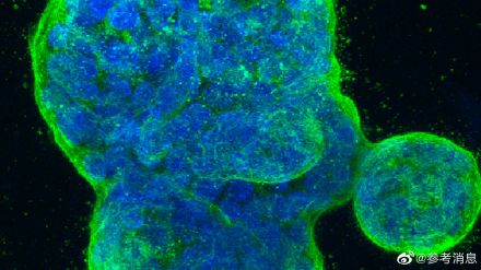癌症疗法研究取得新突破