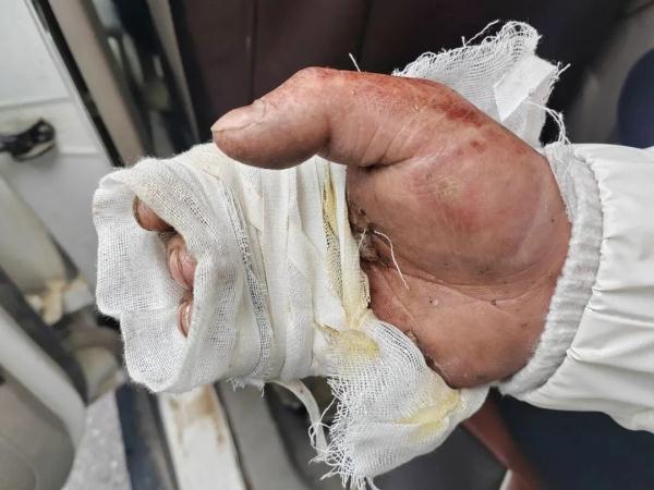 “这伤口不对劲！”他一句话救回一条命