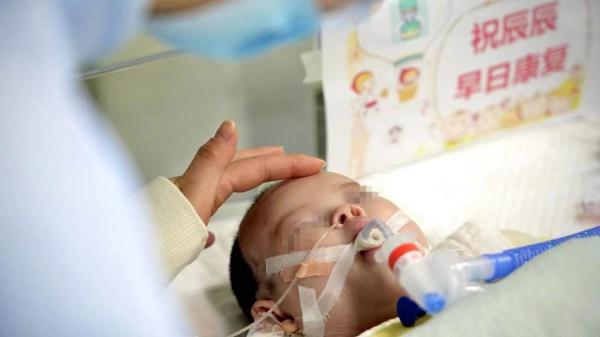再刷亚洲最小换心儿纪录！华科协和医院成功为53天女婴换心