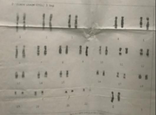 罕见！福建“姐妹花”长成了“哥俩好”！竟因……