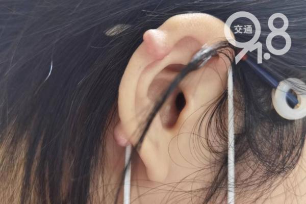 这个"肉疙瘩"是啥？爱美姑娘一个常见举动…崩溃
