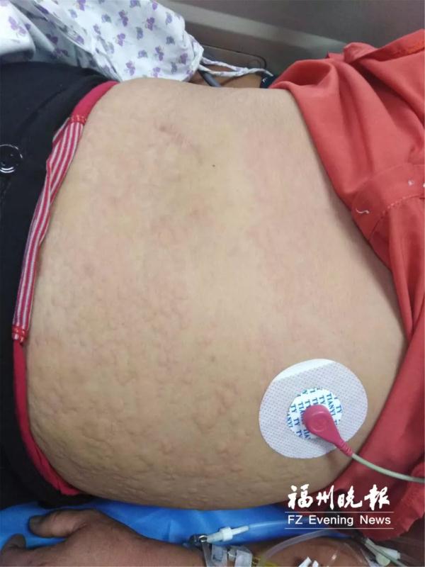 卷土重来！毒性强！南方多地已出现，千万别碰