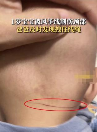 近期频发!家长注意了! 近期频发!家长注意了!