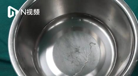 这种水千万别喝！18岁女孩脑中取出活虫！