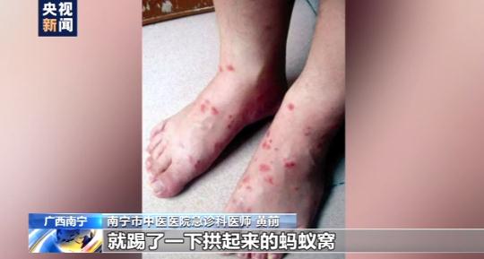 紧急提醒！厦门已出现！就在路边，碰到赶紧躲远！