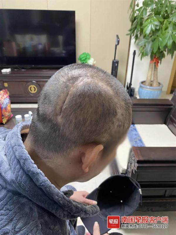 紧急提醒！厦门已出现！就在路边，碰到赶紧躲远！