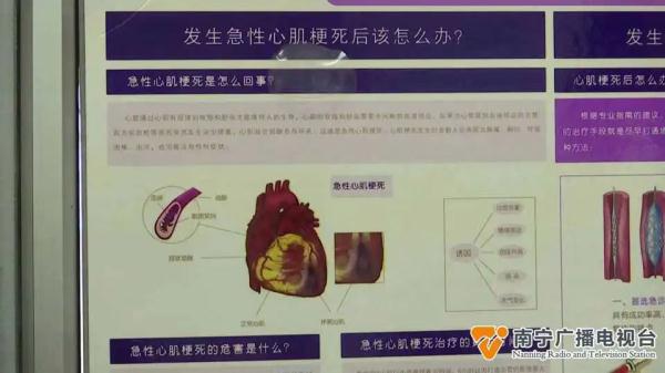 24岁小伙喝了两瓶啤酒心梗发作，医生：这些危险因素要远离→