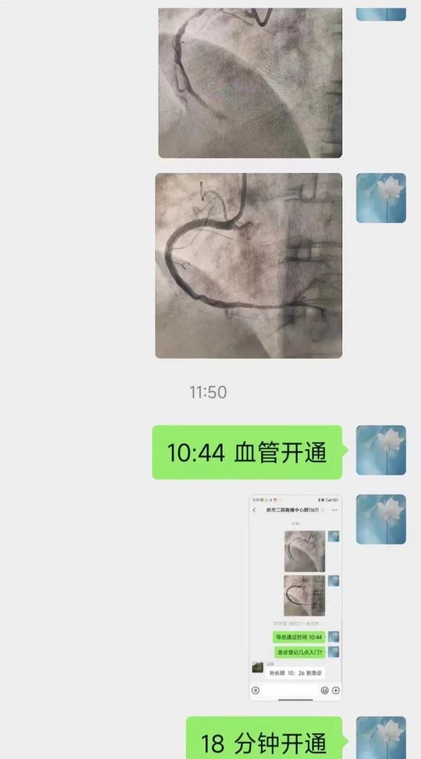 急速18分钟！“双绕行” 为急性心肌梗死患者打通“生命之路”