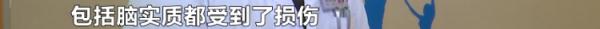 揪心！6岁女孩遭筷子戳眼，直插大脑9cm！事发时家长就在身边……