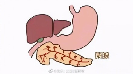 什么是急性胰腺炎?如何预防? 什么是急性胰腺炎?如何预防?